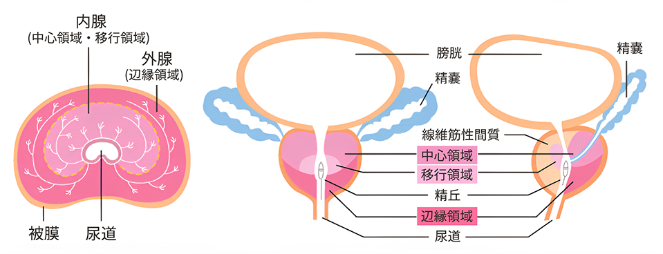 前立腺 東京慈恵会医科大学 泌尿器科