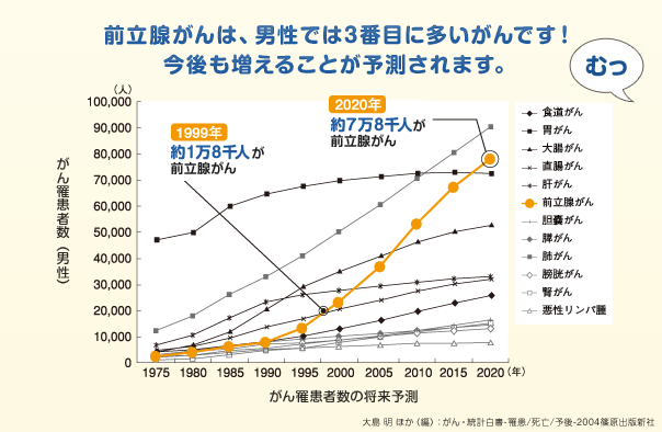 マンガで分かる簡単、感嘆！PSA検査[9]